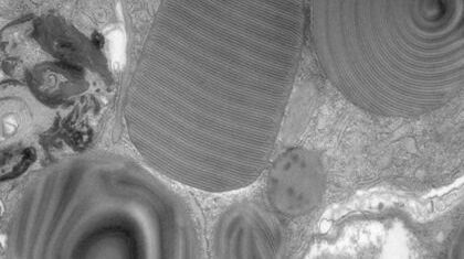 Lamellar structure Lamellar structure