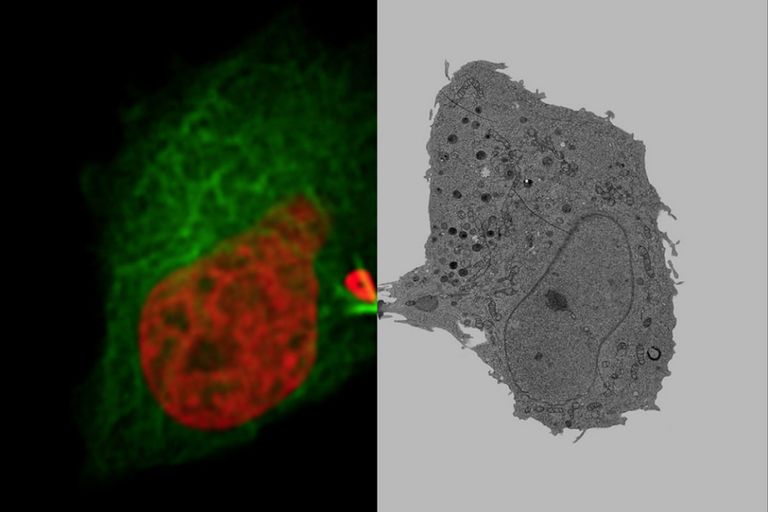 Mammalian cells expressing H2B-mCherry and alphaTubulin-mEGFP to visualize DNA and microtubules respectively were cryo-immobilized by high-pressure freezing 60 min after cytokinesis onset. The intercellular bridge was imaged under TEM after freeze substitution and resin infiltration.