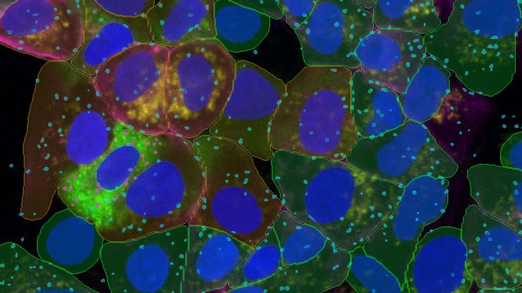 Four-color assay of cultured U2OS cells stained for nuclei (SPY555), actin (ATTO 647N), WGA (AlexaFluor 405), and MX1 (GFP).