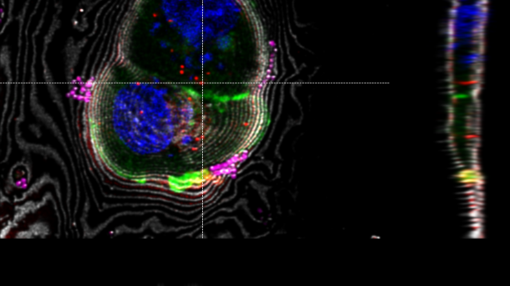 LAS X Coral Cryo: Interpolation based targeting in 3D using sections through the z-stack in x and y direction. The markers can be moved interactively in all relevant windows.