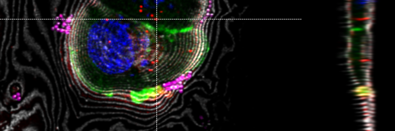 LAS X Coral Cryo: Interpolation based targeting in 3D using sections through the z-stack in x and y direction. The markers can be moved interactively in all relevant windows.