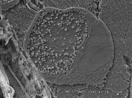 Advance Cryogenic Sample preparation techiniues for electron microscopy