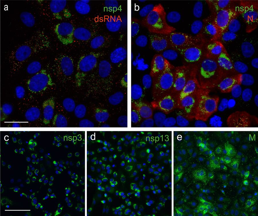 Abb. 3: Immunfluoreszenzmikroskopie von mit SARS-CoV-2 infizierten Vero E6-Zellen, die mit Kaninchen-SARS-CoV-Antiseren behandelt wurden [1]. Nsps-Proteine befinden sich in der Nähe des Zellkerns, während das M-Protein im Golgi-Apparat zu finden ist. Anti-dsRNA-Antikörper wurden verwendet, um replikative Zwischenstufen der viralen RNA-Synthese zu markieren. Die Zellkerne wurden mit Hoechst gefärbt. Der Maßstab beträgt 25 μm für 3a und 3b und 100 μm für 3c, 3d und 3e.