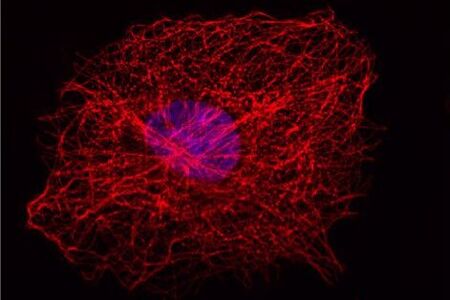 Cellular microtubule network in a fibroblast cell (COS-7