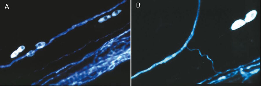 a) Mesenterium of a rat with the small blood vessel surrounded by a blue fluorescent adrenergic (CA) nerve-plexus and yellow fluorescent mast (5-HT) cells. Formaldehyde-induced neurotransmitter fluorescence of CA and 5-HT fluorophores. b) Same tissue and staining as is 6a with epi-illumination and narrow-band violet excitation light (LP 3 mm, Y 400, and SP 425 interference filter), a dichroic beam-splitter for 495 nm, reflecting violet light, and a barrier filter LP 460 nm. This filter cube permittted for the first time the observation of blue fluorescent adrenergic nerve fibers, distinctly different from yellow fluorescent mast cells [25].