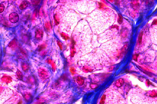 Glande parotide colorée à l’H&E à 12 bits de profondeur avec la caméra de microscope K3.