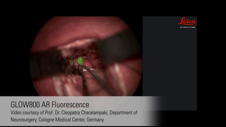 GLOW800 Augmented Reality Fluorescence Application - Media
