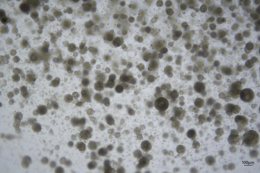 Figure 1: 4x magnification of organoids cluster taken on Mateo TL.Cell type: esophageal squamous carcinoma; scale  bar 100µm.  Courtesy of bioGenous, China. 