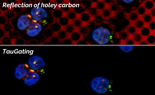 Removal of disturbing background signals derived from the carbon layer. Clamydomonas reinhardtii, two different types of intraflagellar transport proteins, IFT-NeonGreen and IFT-mCherry. 