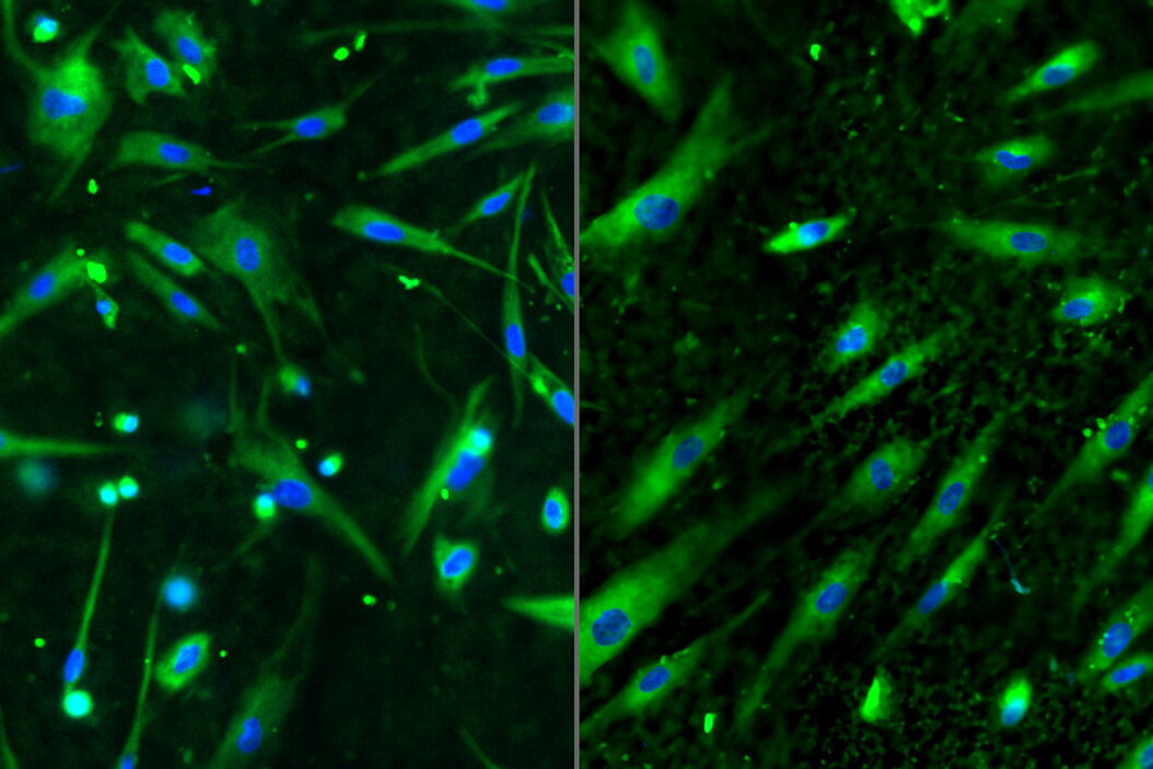 Cellular polarization dynamics before and after magneto-mechanical stimulation Cellular_polarization_dynamics_before_after_magneto-mechanical_stimulation.jpg