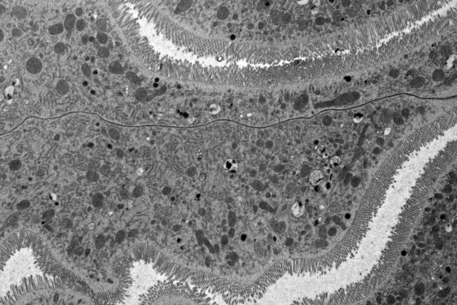 EM micrograph showing an overview of a gastric caeca from Drosophila (fruit fly) prepared with HPF. Courtesy of Dr. Syed and Dr. Bleck, NIH, USA.