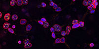 Image of C2C12 cells: The cells are stained with lamin B (magenta) which indicates nuclear structure, Hoechst (blue) indicating DNA, and γH2AX (yellow) indicating damage to DNA. Cells were imaged using a THUNDER Imager 3D Live Cell with a 63X/1.4 oil immersion objective.