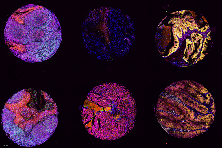 Human tonsil, breast, and colon TMA labeled with ATTOApollo panels.
Credit: Federica Sella and Evelyn Lattmann (USZ Zurich, CH, Mitch Levesque Group)
