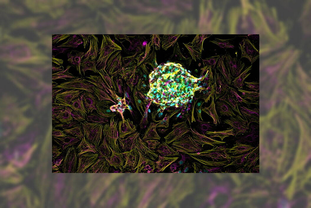 Spheroid shown here as a maximum projection of the raw widefield image data (left) and THUNDER image after Instant Computational Clearing (right). The images are derived from approximately 60 µm Z stacks. Different stains (alpha actin and vimentin) are used to help identify the various cell types. Images courtesy of Sandra Grijalva, Wallace H. Coulter Department of Biomedical Engineering, Georgia Tech and Emory University, Atlanta, USA.  Developing_Heart_Pacemaker_Cells_From_Cardiac_Spheroids_teaser.jpg