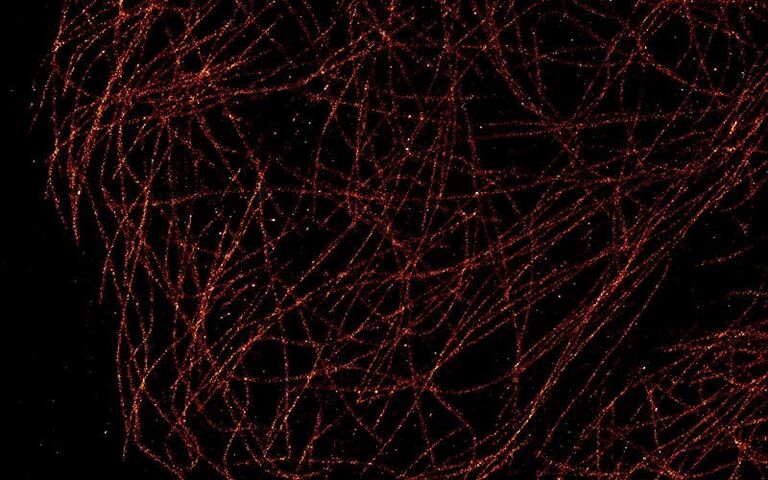 dSTORM image of microtubules stained with Alexa 647
