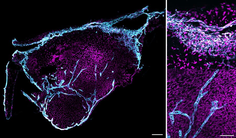 Brain organoid cleared with ECi. Left: Full organoid; scale bar 100 μm. Right: zoomed view; scale bar 50 μm. Nuclei are shown in magenta and the vascular network in cyan. Courtesy of Professor Barbara Treutlein (ETH-DBSSE, Basel, Switzerland).