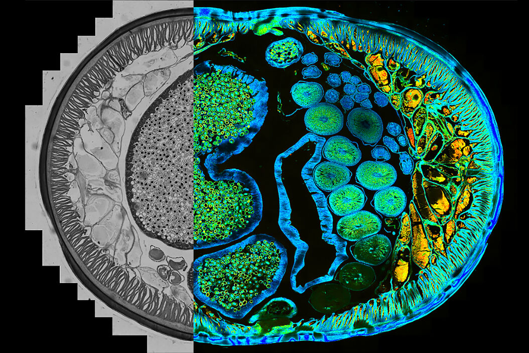 Identification of distinct structures_roundworm_Ascaris_female Identification of distinct structures_roundworm_Ascaris_female Identification_of_distinct_structures_roundworm_Ascaris_female.jpg