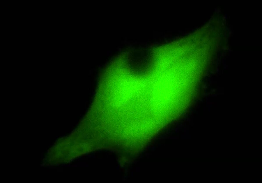 Some microscopy techniques demand the simultaneous coupling of additional light sources or lasers. For example, bleaching during the course of FRAP experiments is executed by a laser coupled into the infinite light path.
