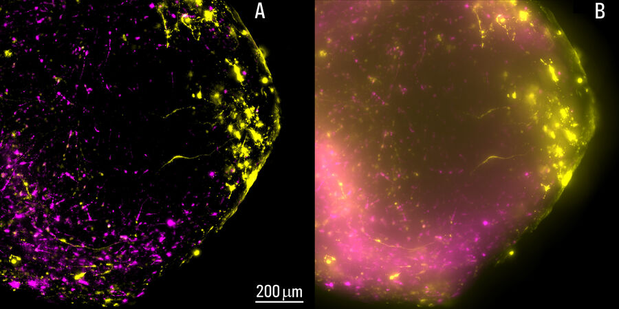 Studying Human Brain Development and Disease | Science Lab | Leica ...