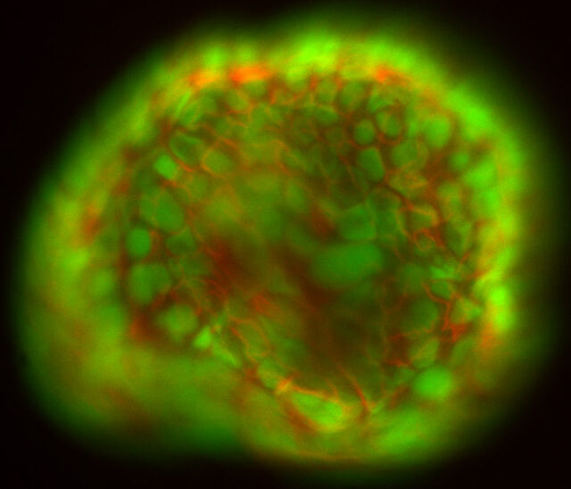 z-Stapel eines Organoids