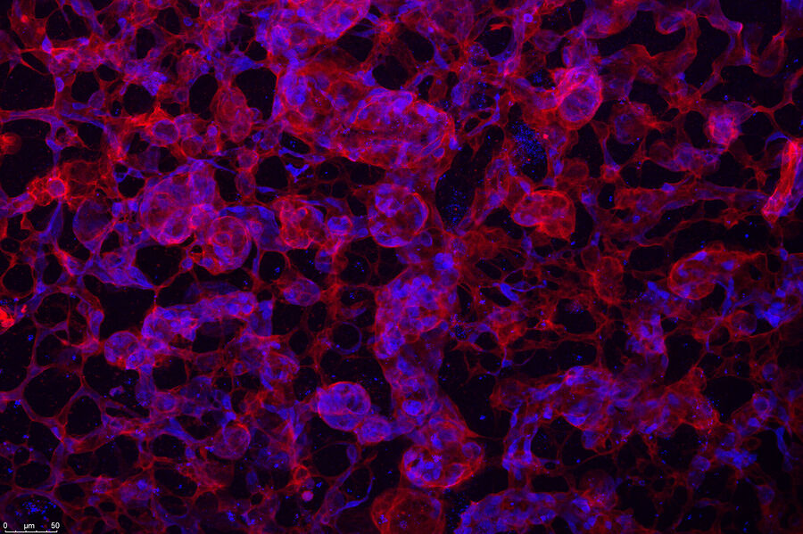 Maximum projection of confocal stacks showing vascular malformations in a retina at postnatal day 16, in which Cdc42 has been conditionally deleted in endothelial cells. Maximum projection of confocal stacks showing vascular malformations in a retina at postnatal day 16, in which Cdc42 has been conditionally deleted in endothelial cells.