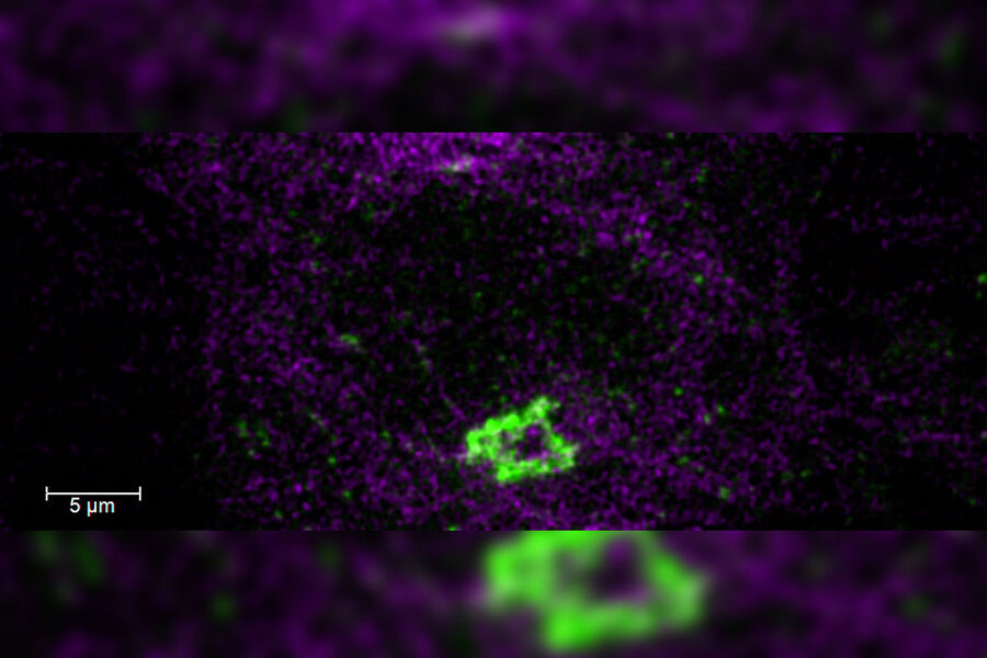 HeLa Kyoto 세포입니다. 제공: Dr. Juan Jung, EMBL, Heidelberg, Germany.