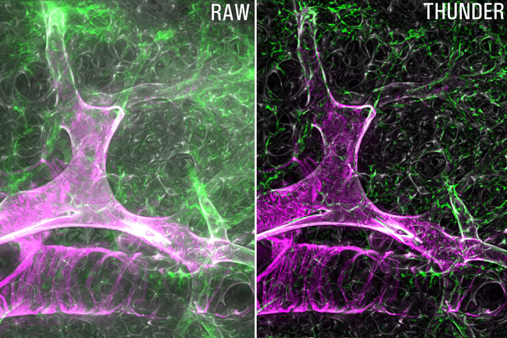 Images of mouse lung: (left) raw widefield and (right) after the THUNDER technology instant computational clearing (ICC). Courtesy of Dr. Ross Metzger, CA, USA.