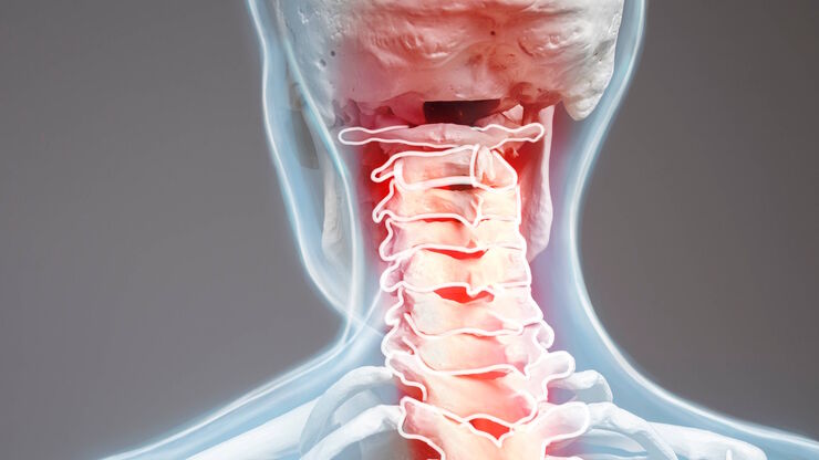 Strain from using a microscope can lead to musculoskeletal pain. Strain from using a microscope can lead to musculoskeletal pain.