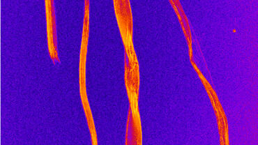 STELLARIS CRS Coherent Raman Scattering Microscope - Applications ...