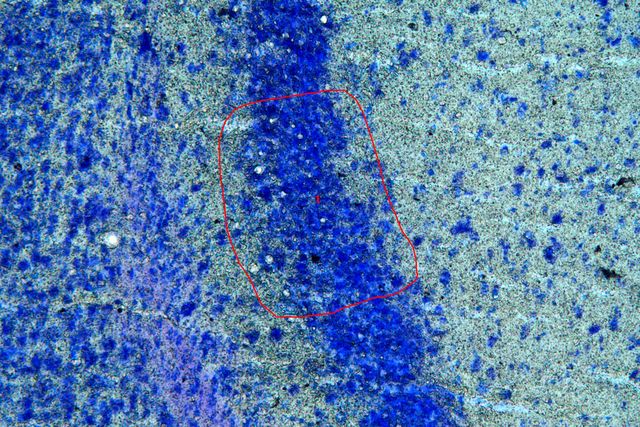 Sample before laser microdissection.