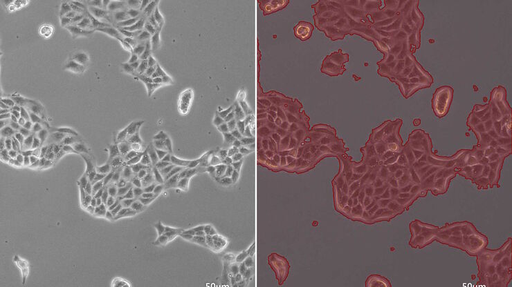 Phase-contrast image of a MDCK-cell culture and its respective confluency measured by the Mateo TL microscope. Phase-contrast image of a MDCK-cell culture and its respective confluency measured by the Mateo TL microscope.