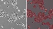 Phase-contrast image of a MDCK-cell culture and its respective confluency measured by the Mateo TL microscope.