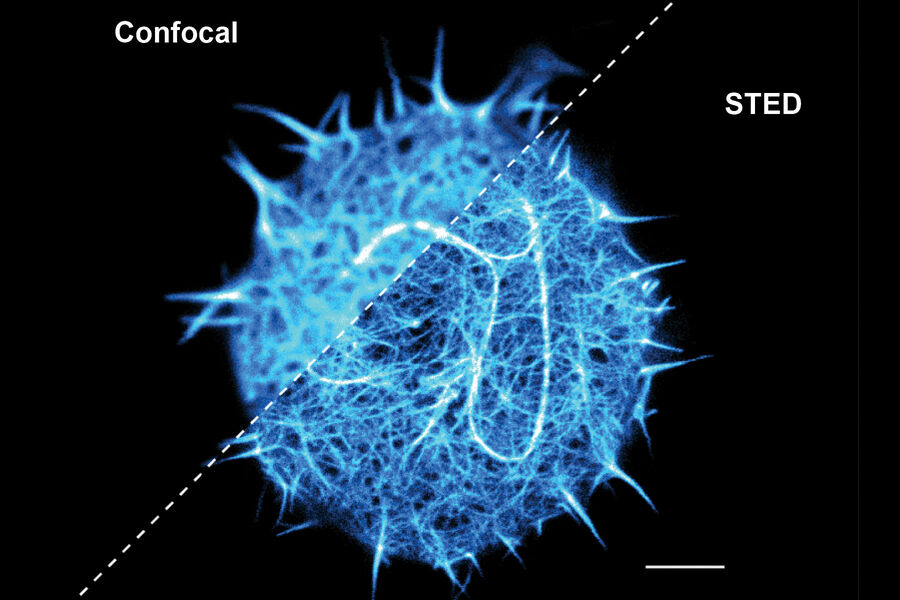 Living T cell in suspension. 3D reconstruction of confocal and STED stacks.