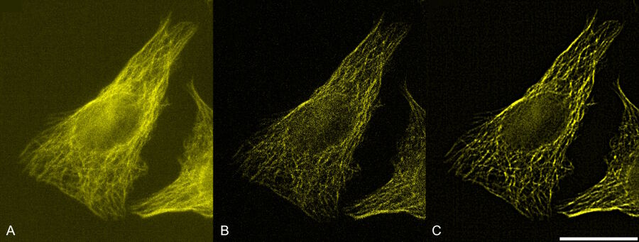 U2OS cell stained with SiR700 actin. 