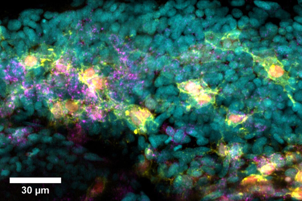  Fixed_zebrafish_embryos_in_Agarose_PBS.jpg