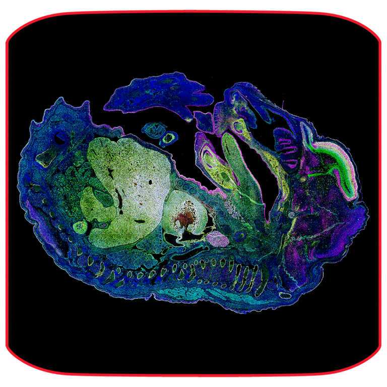 Mouse embryo (E15.5) cryosection captured with the PL APO 20x/0.75 CS2 objective. Section shows Tbr2 cells labeled with CF488A, Satb2 cells labeled with CF555 and Ctip2 cells with CF633 plus nuclei counterstaining with DAPI. The acquisition of two sections took less than 5 minutes, while previously it took 2 hours on the lab’s comparison device. Sample and images are courtesy of Giulia Di Muzio at the lab of Dr. Pei-Chi Wei at the DKFZ, Heidelberg, Germany.