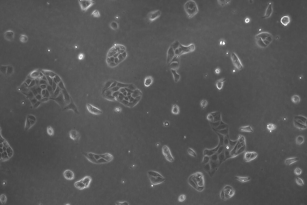Csm Lmd Hela Cells 05 2990f0caa0