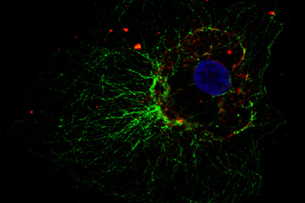 Cellular microtubule network in a fibroblast cell. Cellular microtubule network in a fibroblast cell. lms-how-to-prepare-specimen-immunofluorescence-microscopy-sl-article-header.jpg