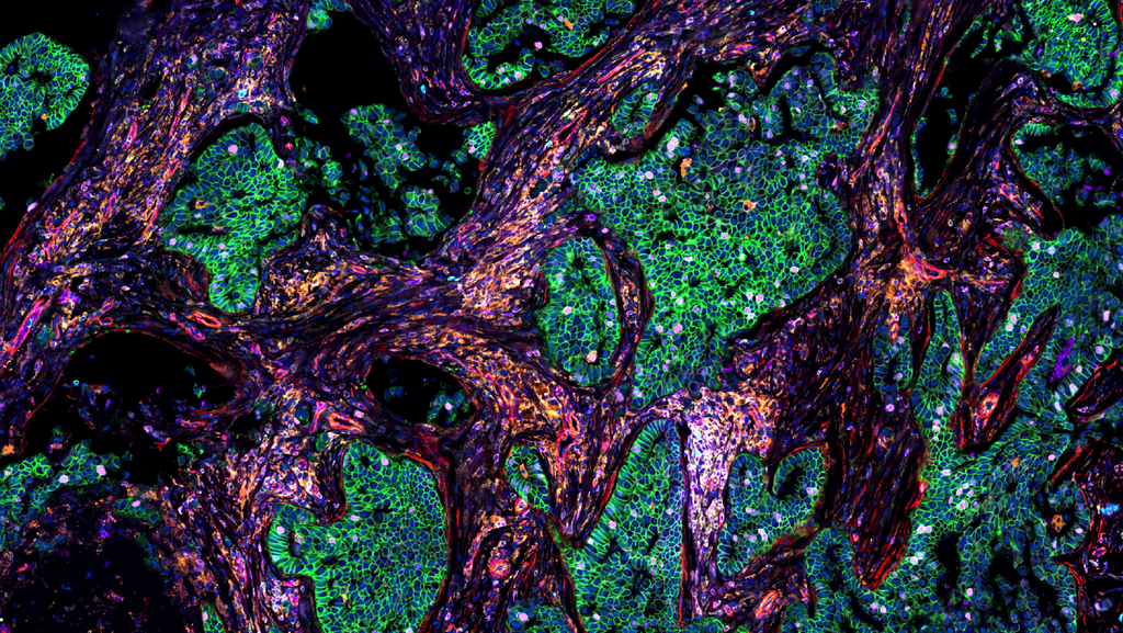Advanced Tissue Imaging & Analysis | Applications | Leica Microsystems