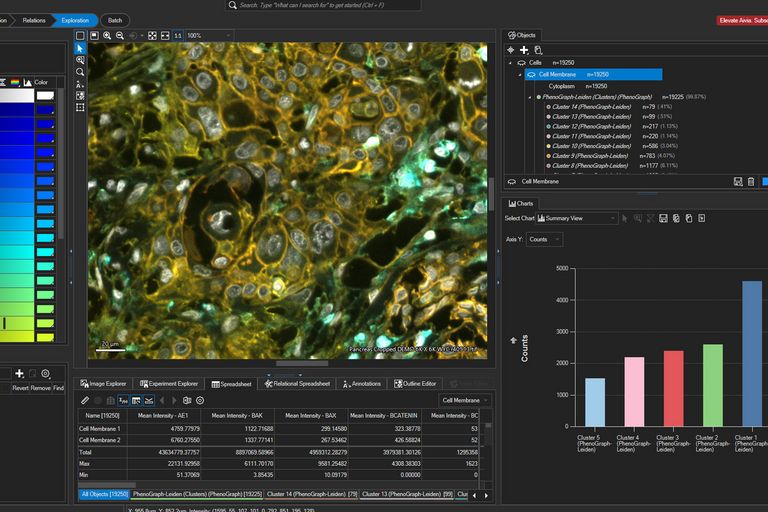 Generate rapid insights from different measurements by updating charts with Measurement Selectors. Image credit: pancreatic ductal cancer tissue section by Melinda Hill, Ph.D., Leica Microsystems., analyzed using Aivia by Won Yung Choi, Ph.D. of Leica Microsystems.
