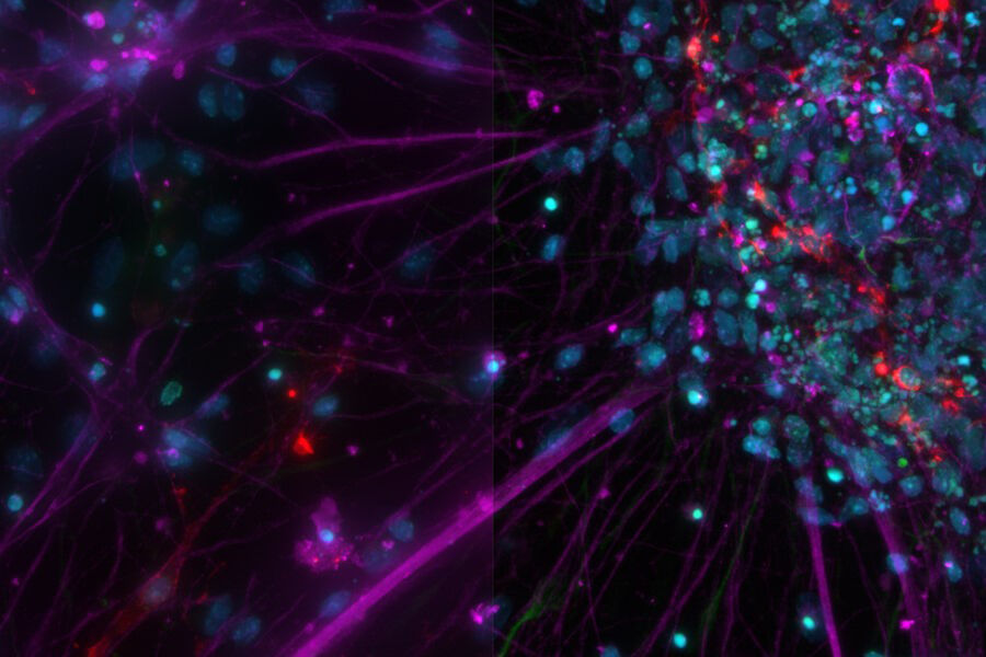 Primary culture, rat - THUNDER Imager 3D Cell Culture