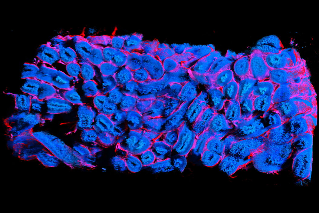 3D reconstruction of an intact 6 × 3 × 1.5 mm testis sample from a SMMHC-CreERT2 x Ai14D mouse after tissue clearing. Analyzing_the_structural_and_functional_anatomy_of_mouse_testicular_tissue_teaser.jpg