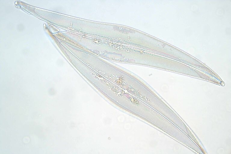 Diatoms imaged with brightfield illumination and a 40X objective lens.
