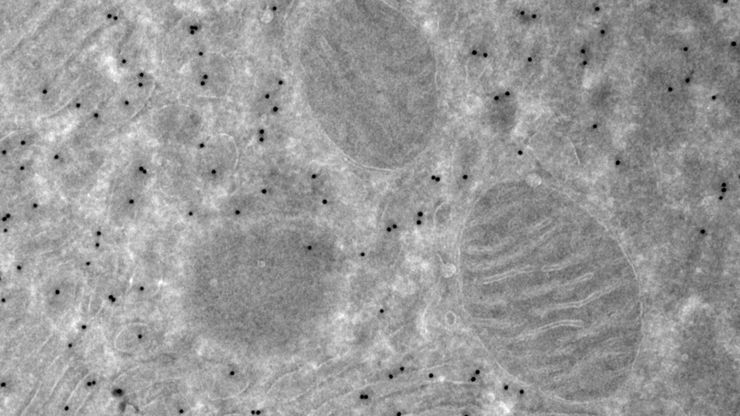 Tokuyasu cryo-sectioning with UC Enuity. Cryo EM of Rat Exocrine Pancreas.