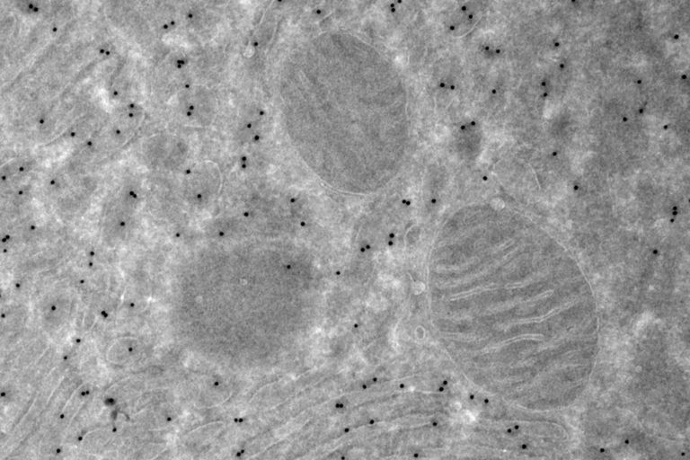 Tokuyasu cryo-sectioning with UC Enuity. Cryo EM of Rat Exocrine Pancreas. Protein-A-Gold 10nm labelling of anti KDEL10C3; Stained with Uranyloxalate. Images and samples courtesy Viola Oorshot, (EMCF and the Schwab team, CBB Unit EMBL Heidelberg, Germany).
