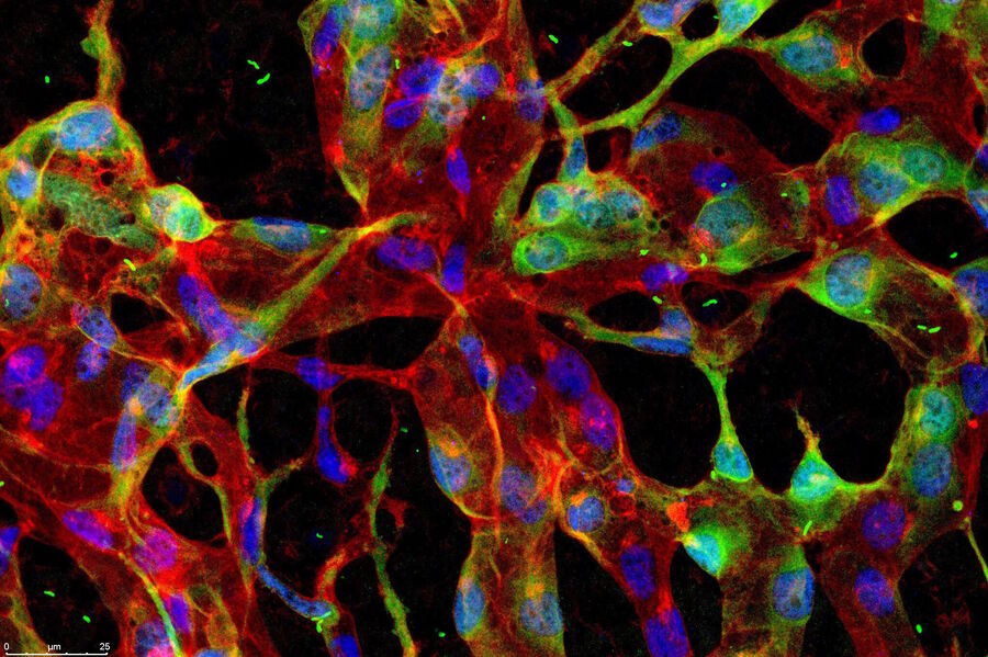 Maximum projection of confocal stacks showing the angiogenic sprouting front where the endothelial cells in the tip position are mutant and thus do not form filopodia. Maximum projection of confocal stacks showing the angiogenic sprouting front where the endothelial cells in the tip position are mutant and thus do not form filopodia.