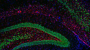Image: Adult rat brain. Neurons (Alexa Fluor488, green), Astrocytes (GFAP, red), Nuclei (DAPI, blue). Image courtesy of Prof. En Xu, Institute of Neurosciences and Department of Neurology of the Second Affiliated Hospital of Guangzhou Medical University, China.