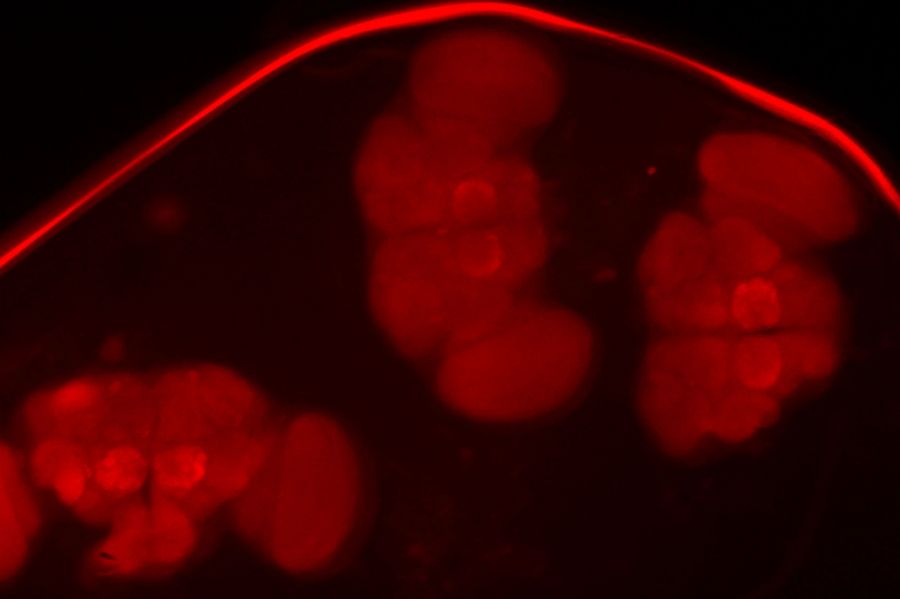 Three brains dissected from fruit flies expressing red fluorescent protein. Courtesy of L. Geid and T. Hummel, Dept. of Neurobiology, University of Vienna, Austria.