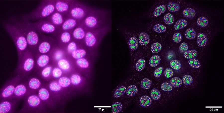 Immortalised mouse pancreatic epithelial cells