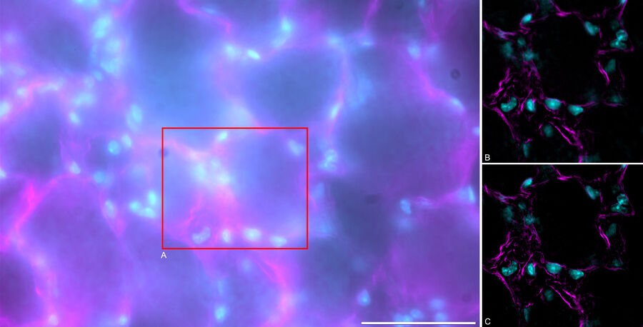 Uncleared mouse lung tissue for studying type I alveolar epithelial cells